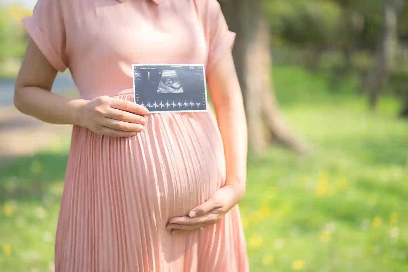 Babymoon Adalah Liburan yang Sedang Hits di Kalangan Ibu Hamil, Yuk, Intip Tren 2025!